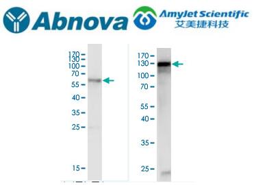 Abnova actn4 purified rabbit polyclonal antibody instructions